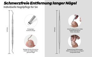 Schmerzfreie Entfernung langer Nägel