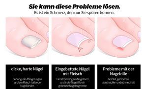 Professionelle Designs zur Lösung von Nagelproblemen